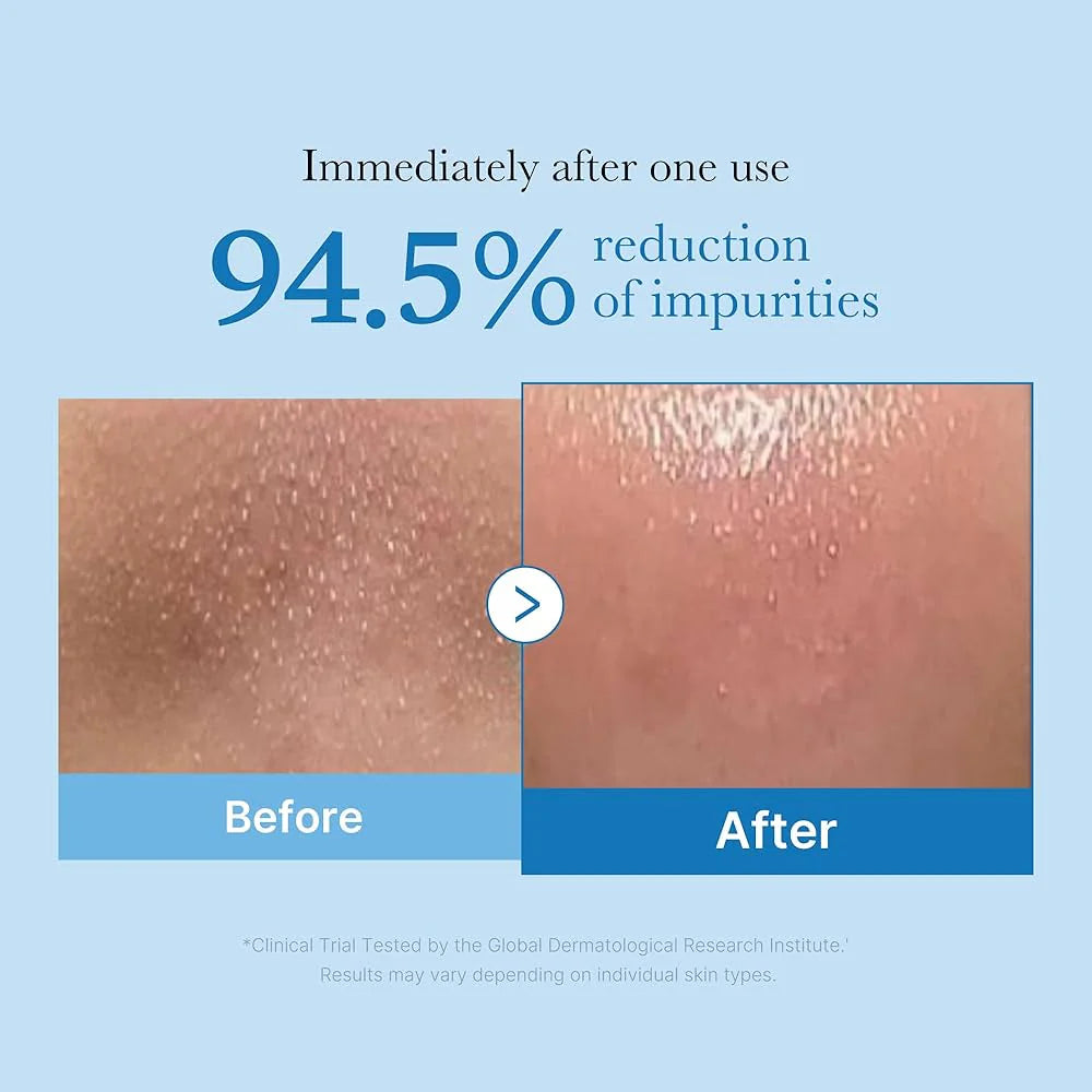 Medicube | Zero Pore Blackhead Deep Cleansing Oil
