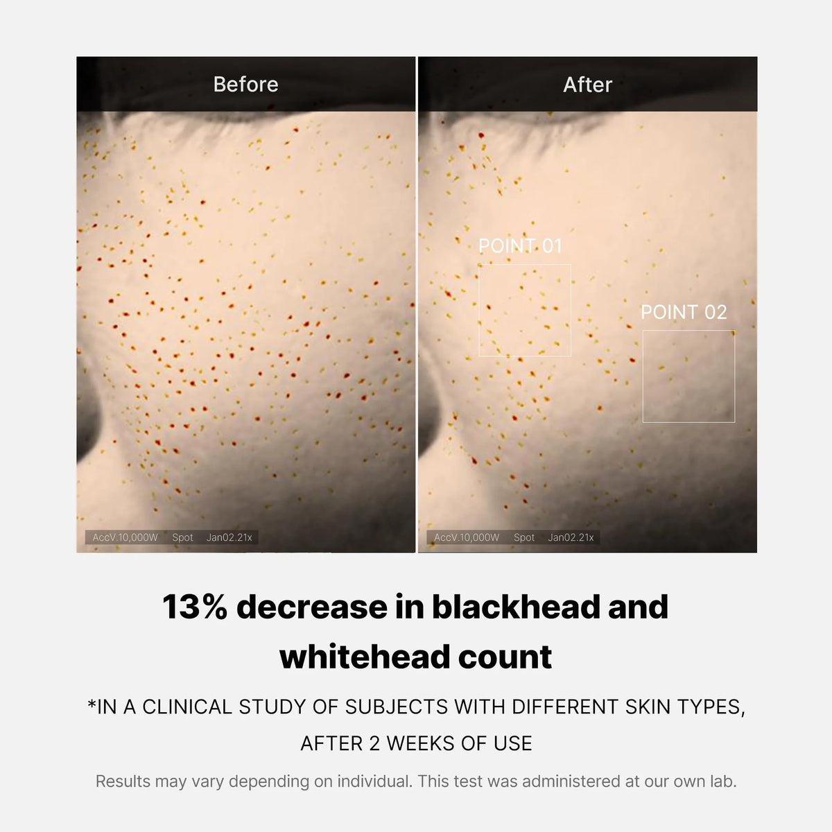 Medicube | Zero Pore One Day Serum