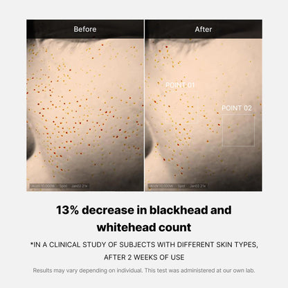 Medicube | Zero Pore One Day Serum