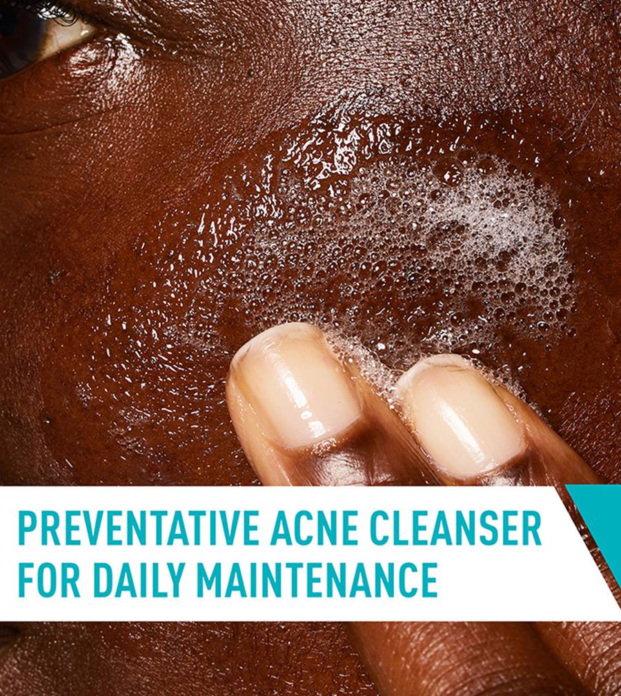 CeraVe | Acne Control Cleanser (Salicylic Acid) | acne-targeted