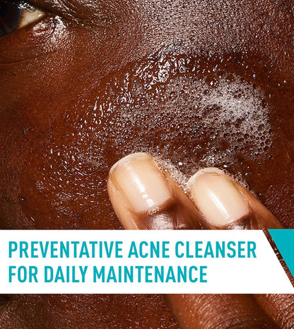 CeraVe | Acne Control Cleanser (Salicylic Acid) | acne-targeted