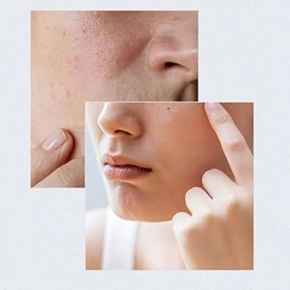 Anua | Birch Moisture Boosting Serum