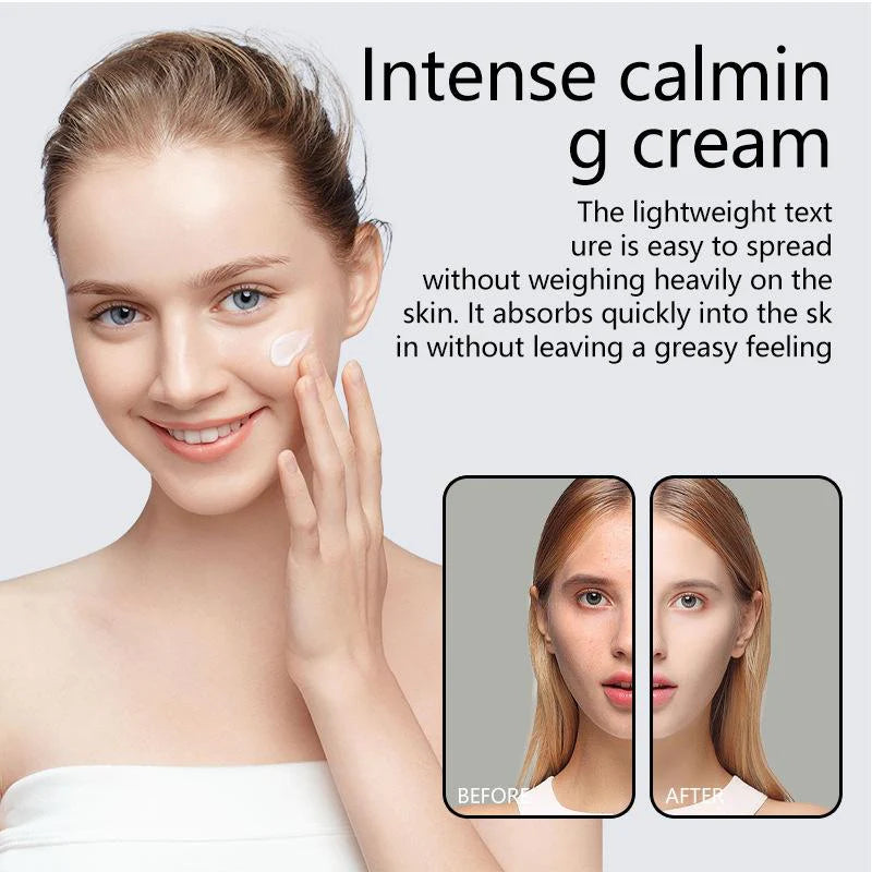 Anua | Heartleaf 70% Intense Calming Cream