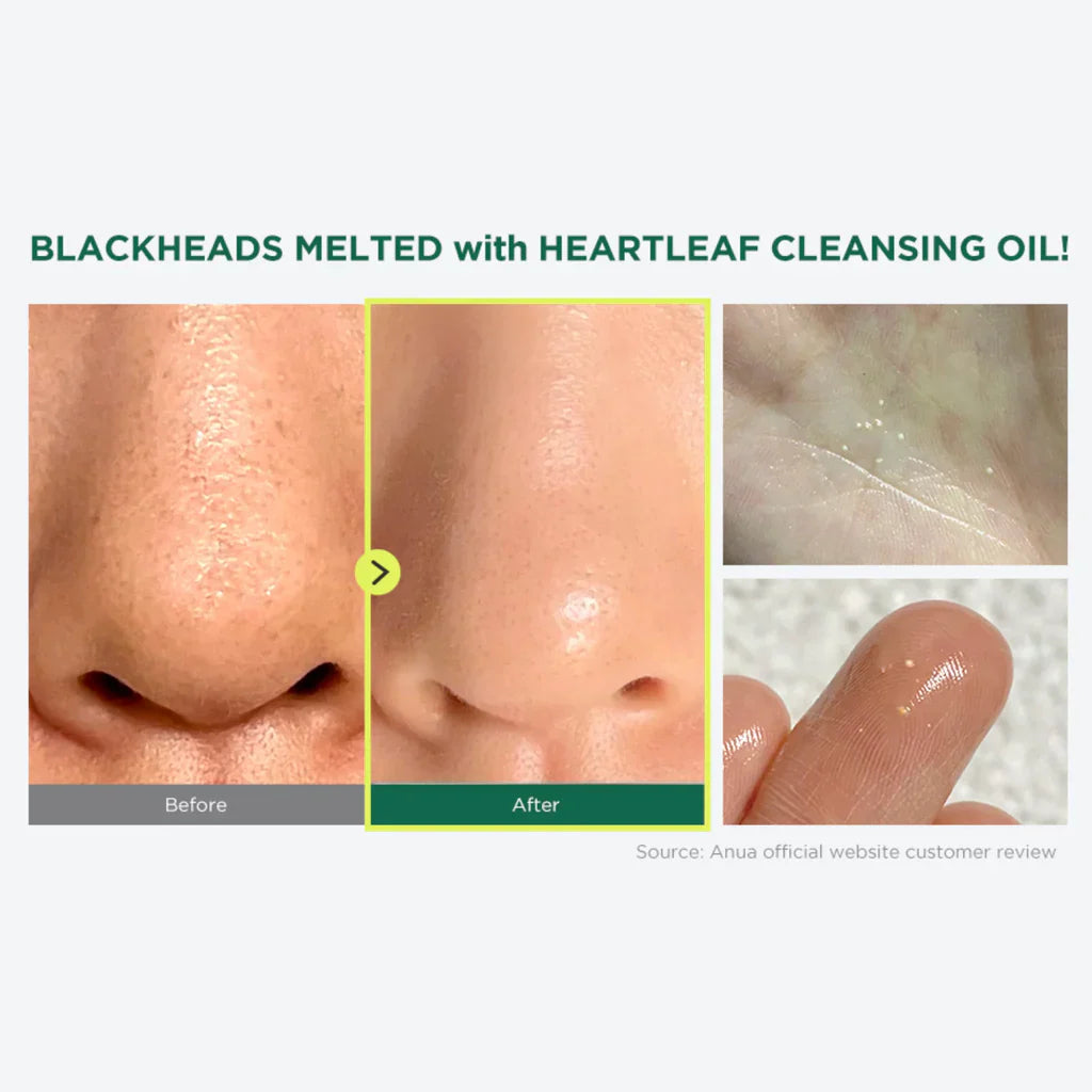 Anua | Heartleaf Pore Control Cleansing Oil