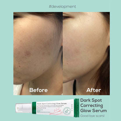 AXIS-Y | Dark Spot Correcting Glow serum