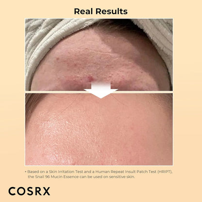 Cosrx | Advanced Snail 96 Mucin Power Essence