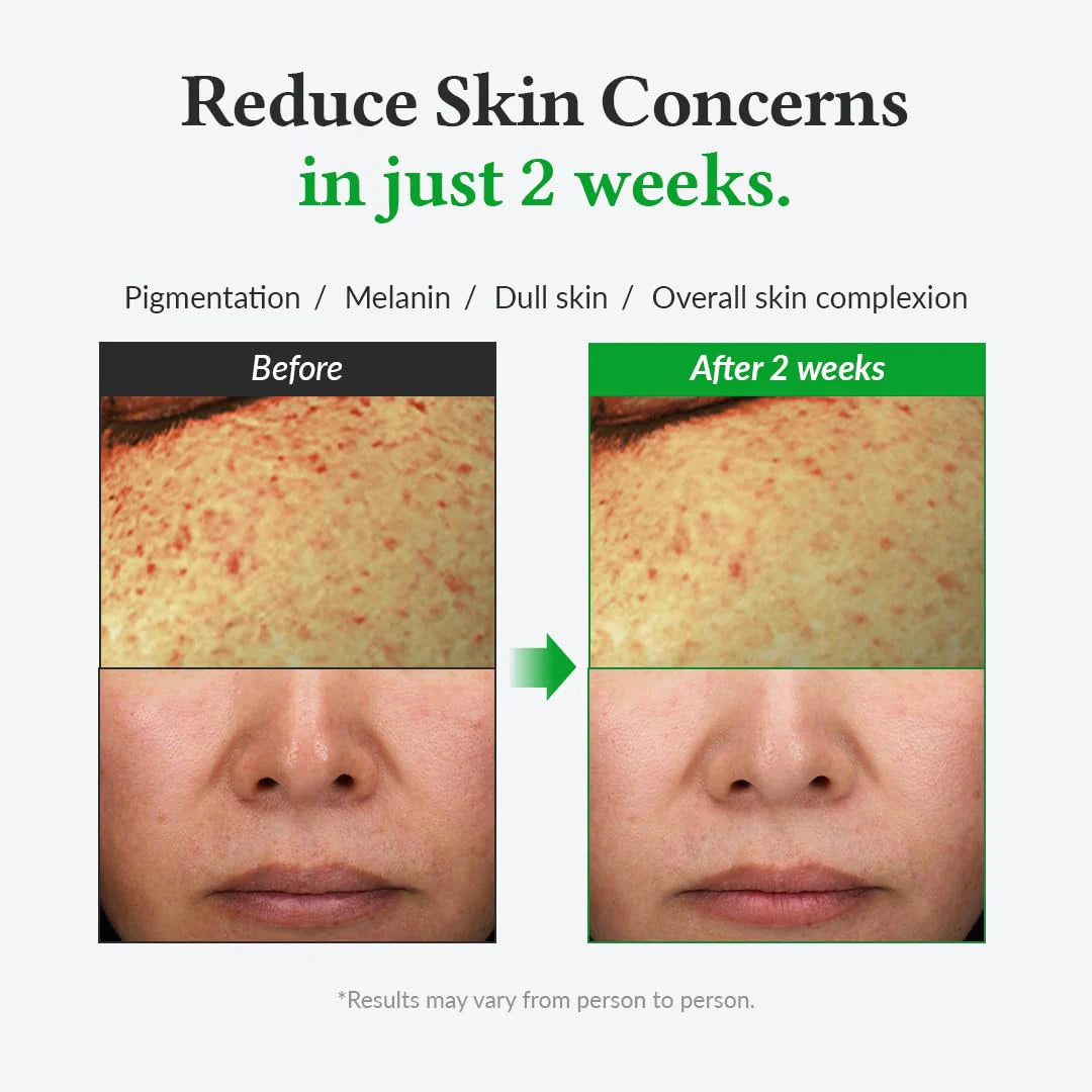 Dr. Althea | Gentle Vitamin C Serum