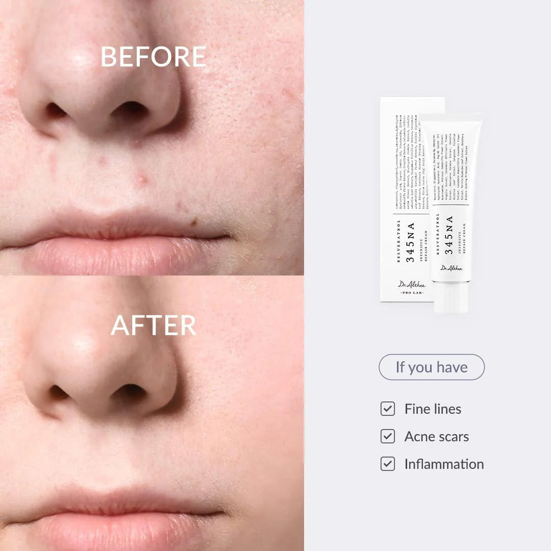 Dr.Althea | 345 Relief Cream