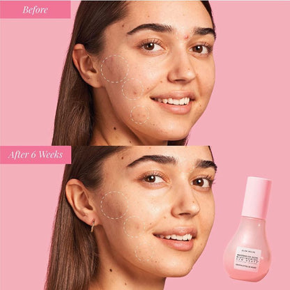 Glow Recipe | Watermelon Glow Niacinamide Dew Drops 40ml