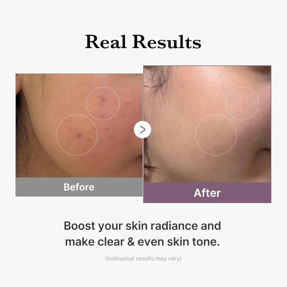 Medicube | AGE-R Glutathione Glow Milk Toner