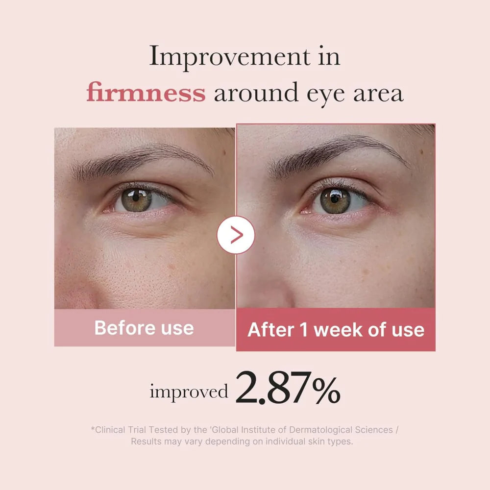 Medicube PDRN Pink Peptide Eye Serum