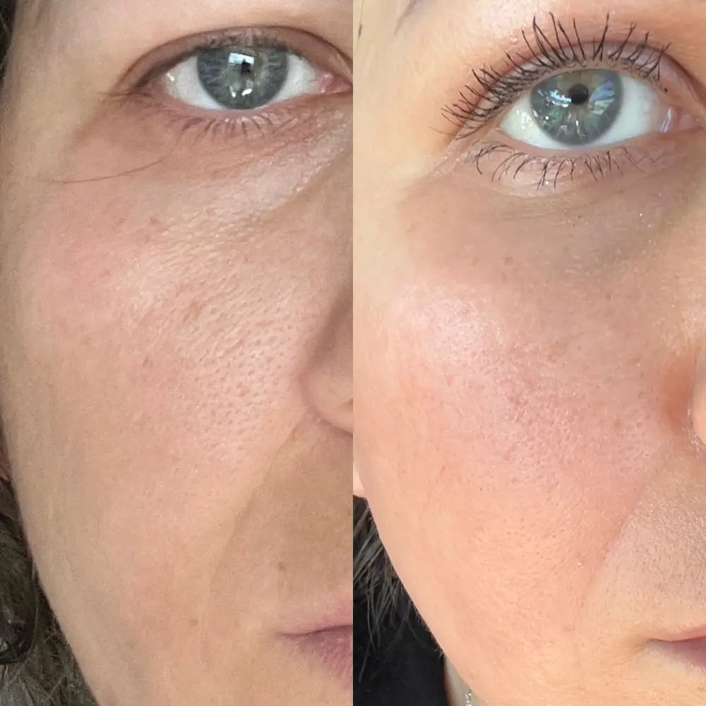 Medicube | Zero Pore Cream 2.0