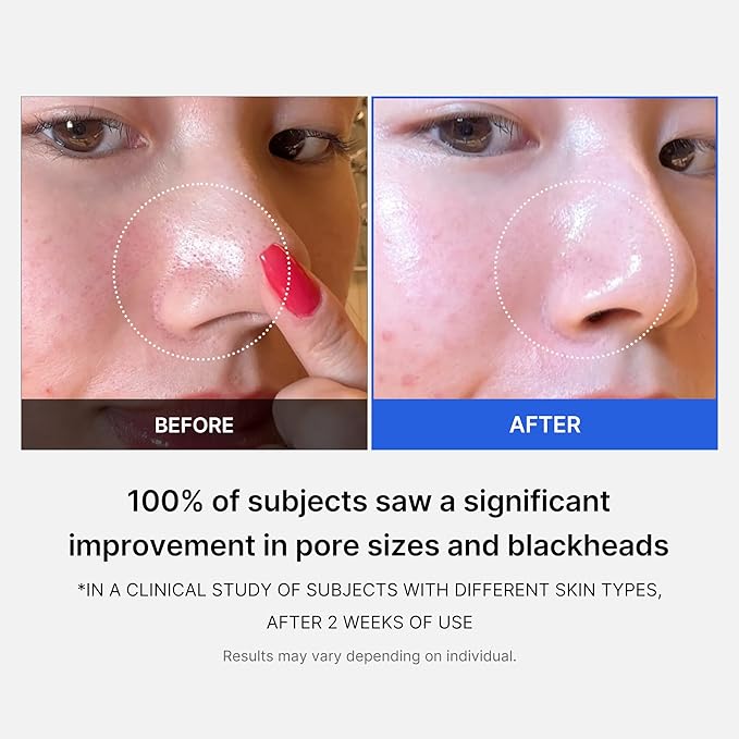 Medicube | Zero Pore Pad 2.0 (70pcs)