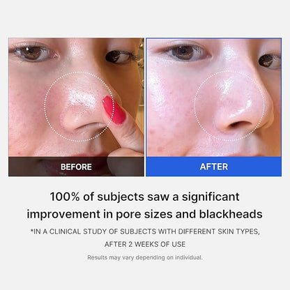 Medicube | Zero Pore Pad 2.0 (70pcs)