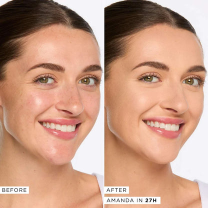 Tarte | Shape Tape™ Concealer