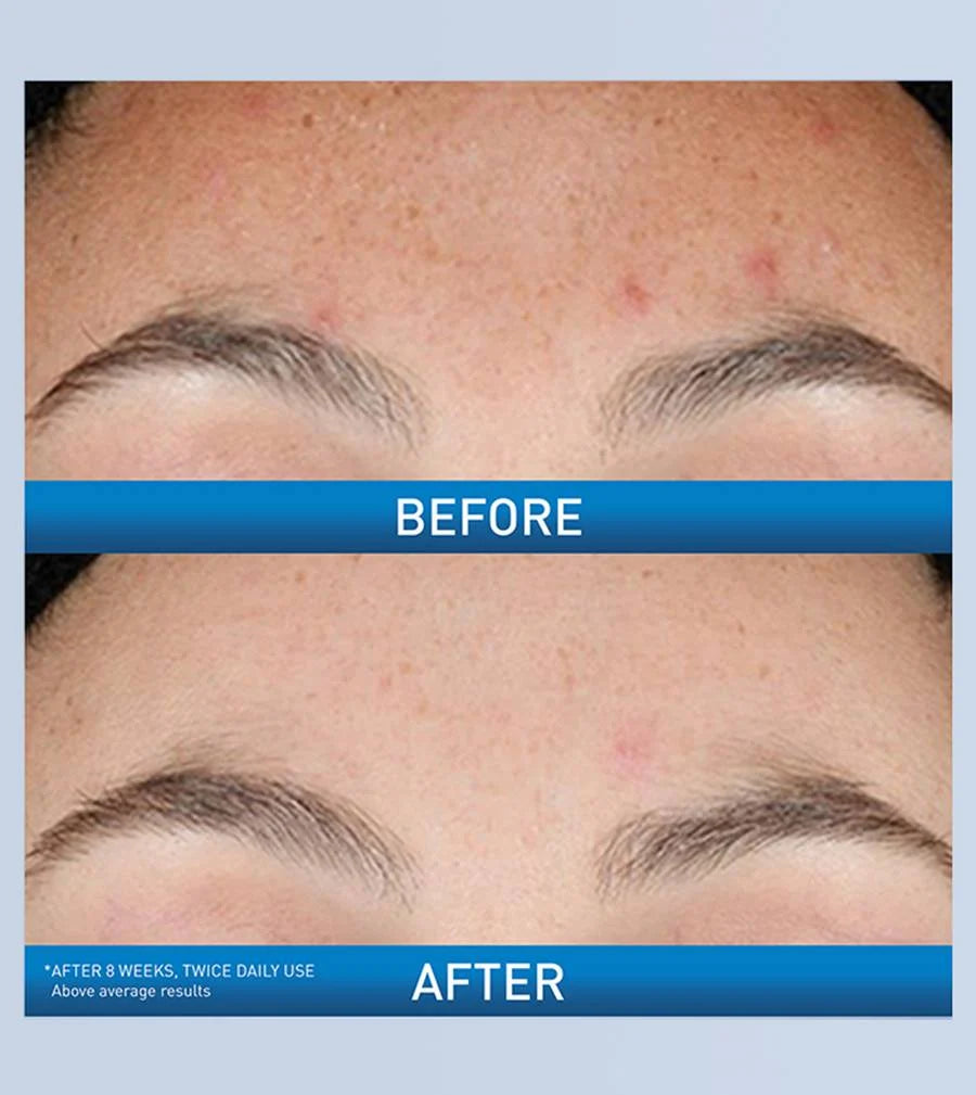CeraVe | Resurfacing Retinol Serum | for aging and texture