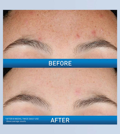 CeraVe | Resurfacing Retinol Serum | for aging and texture
